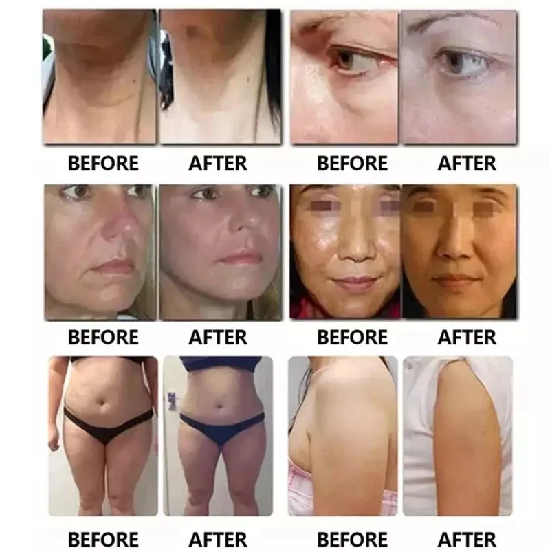 Professional 7D Machine Ultra Face Lifting Anti-wrinkle Skin Lifting Body Slimming Wrinkle Removal with 2 Handles Device Origina