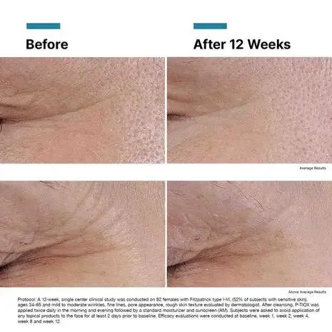 SkinCeuticals P-TIOX Wrinkle Modulating Peptide Serum